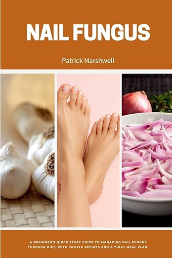 Nail Fungus: A Beginner's Quick Start Guide to Managing Nail Fungus Through Diet